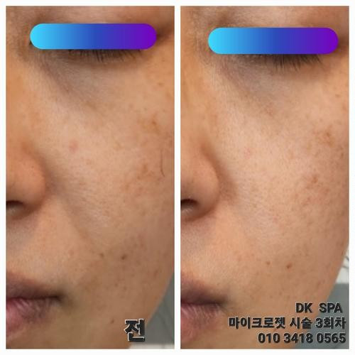 대표 썸네일
